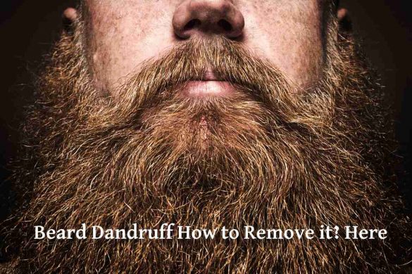 Beard Dandruff