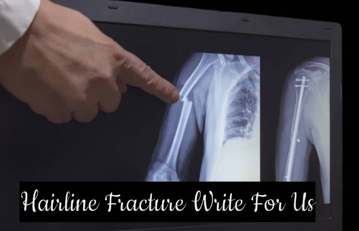 Hairline Fracture Write For Us