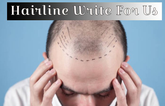 Hairline Write For Us