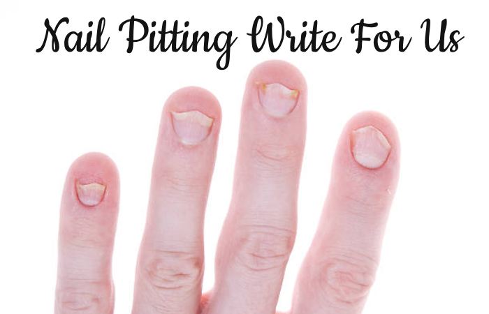 Nail Pitting Write For Us