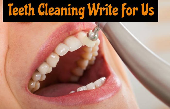 Teeth Cleaning Write For Us