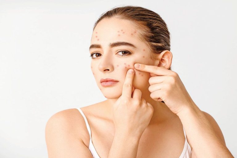 Breaking Down Acne Myths_ What Really Works_