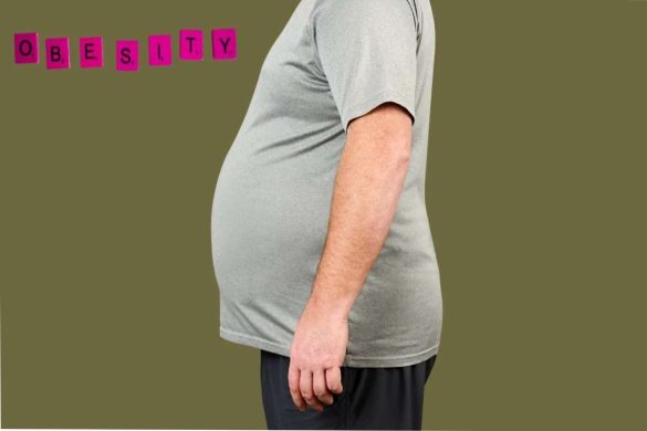 Understanding Obesity