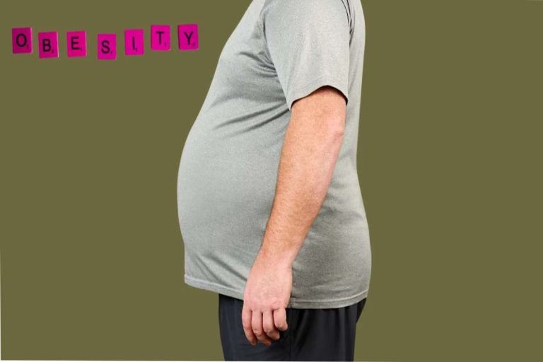 Obesity