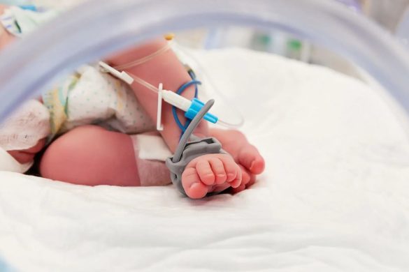 Birth Injury Lawyers