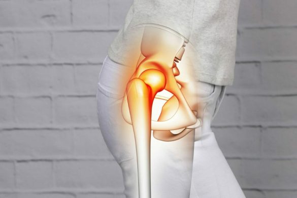 What Happens If You Wait Too Long to Treat Hip Pain_