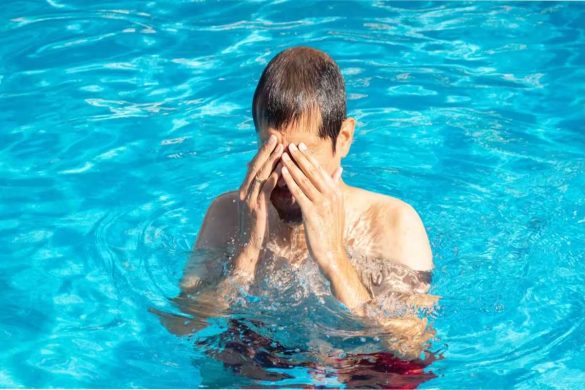 Chlorine on the Skin