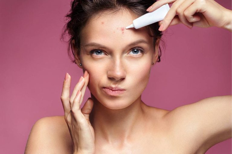 Acne-Related Anxiety and Depression