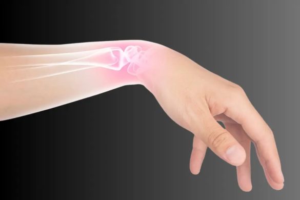 Risk Factors for Hand Fractures